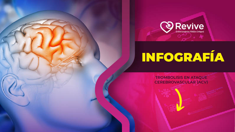 Trombolisis en ataque cerebrovascular